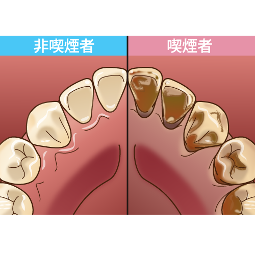 着色